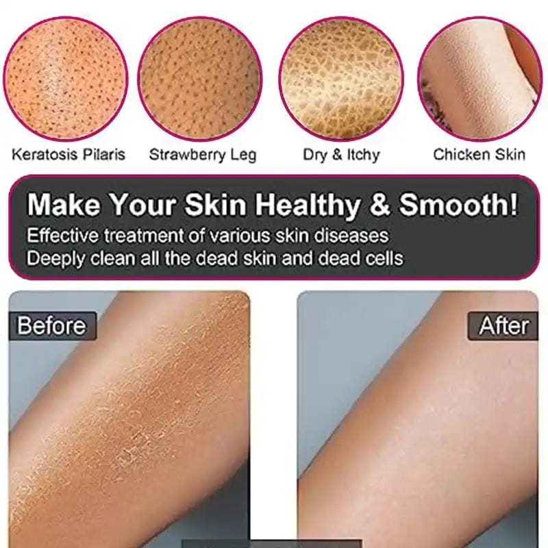 Deep Exfoliating Gloves